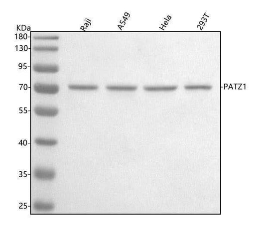 Anti-PATZ1 Antibody Picoband® Boster Bio