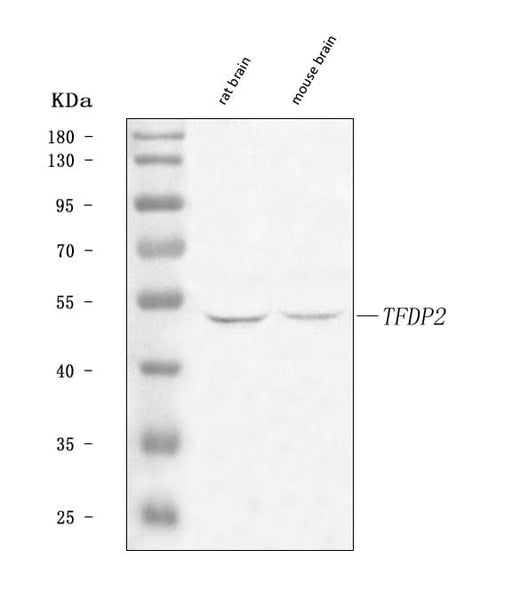 Anti-DP2/TFDP2 Antibody Picoband® Boster Bio