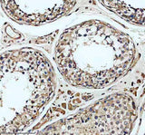 Anti-SLC22A16 Antibody Boster Bio