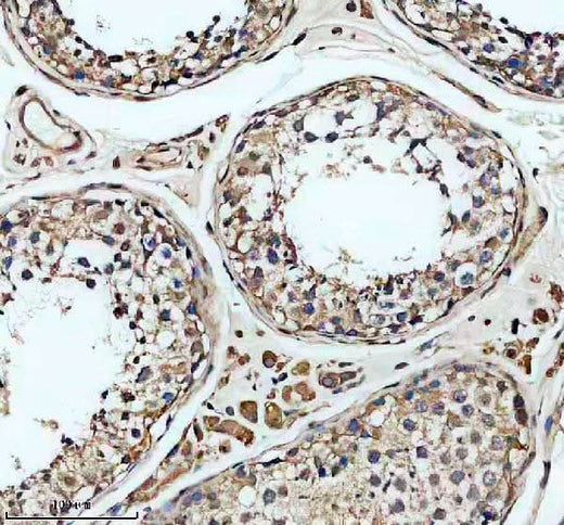 Anti-SLC22A16 Antibody Boster Bio