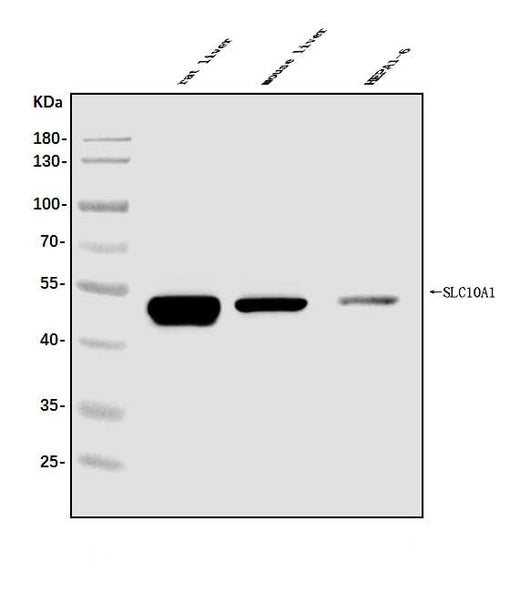 Anti-SLC10A1/NTCP1 Antibody Picoband® Boster Bio