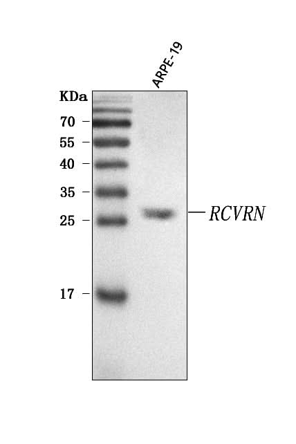 Anti-Recoverin/RCVRN Antibody Picoband® Boster Bio