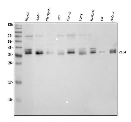 Anti-IL34 Antibody Picoband® Boster Bio