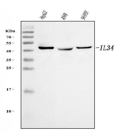 Anti-IL34 Antibody Picoband® Boster Bio