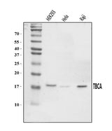 Anti-CFA/TBCA Antibody Picoband® Boster Bio