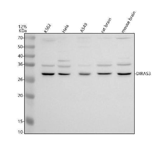 Anti-DUSP23 Antibody Picoband® Boster Bio