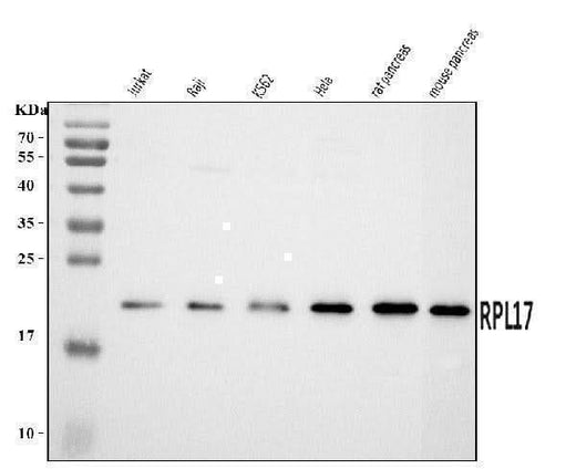 Anti-RPL17 Antibody Picoband® Boster Bio