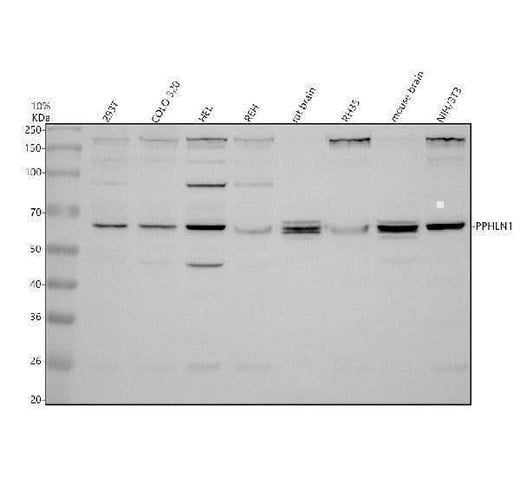 Anti-Periphilin 1/PPHLN1 Antibody Picoband® Boster Bio