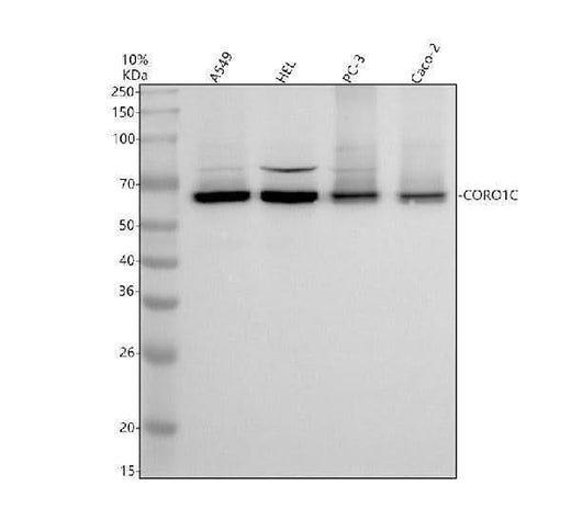 Anti-CORO1C Antibody Picoband® Boster Bio