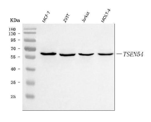 Anti-TSEN54 Antibody Picoband® Boster Bio