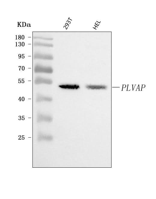 Anti-PLVAP Antibody Picoband® Boster Bio