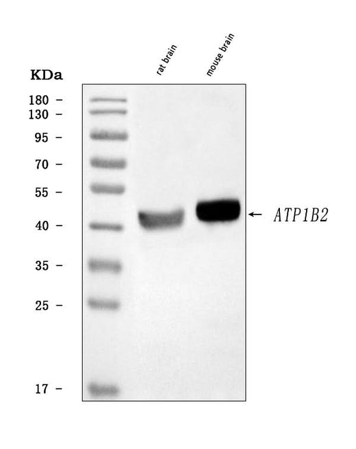 Anti-ATP1B2 Antibody Picoband® Boster Bio