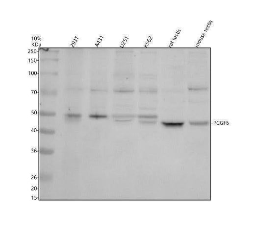 Anti-PCGF6 Antibody Picoband® Boster Bio
