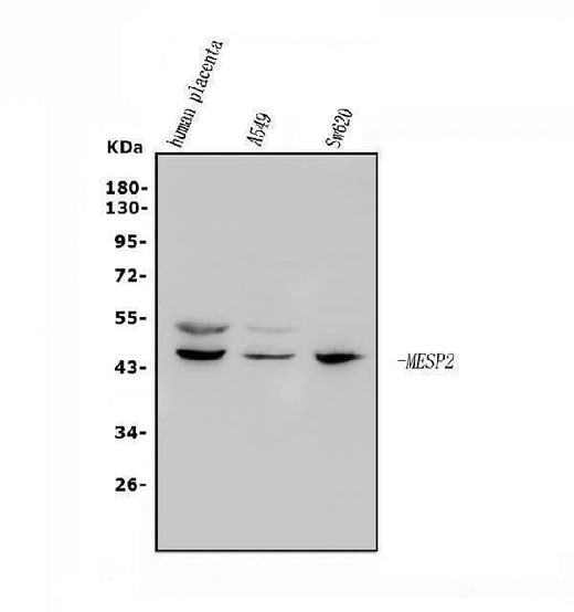 Anti-Mesp2 Antibody Picoband® Boster Bio