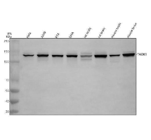 Anti-TAOK1 Antibody Picoband® Boster Bio