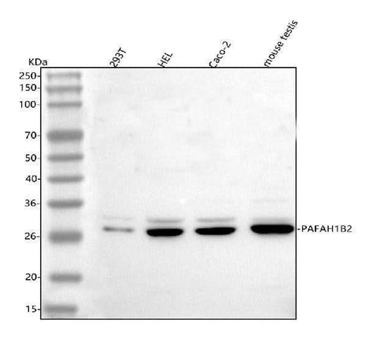 Anti-PAFAH1B2 Antibody Picoband® Boster Bio