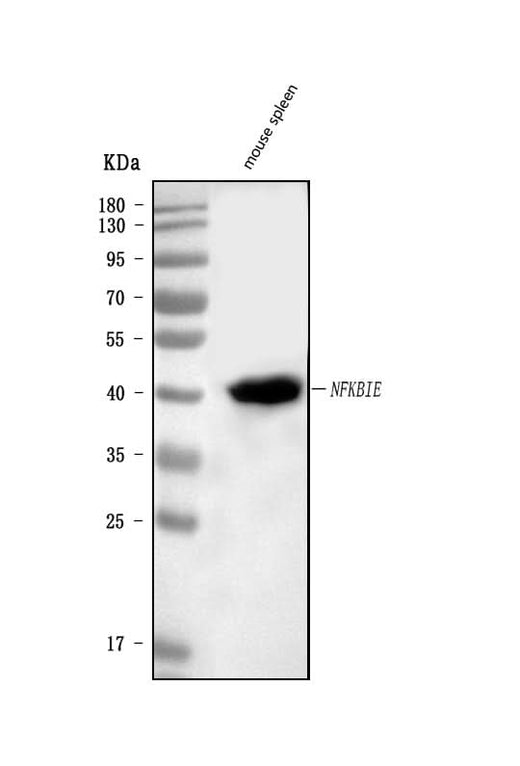 Anti-IKB epsilon/Nfkbie Antibody Picoband® Boster Bio
