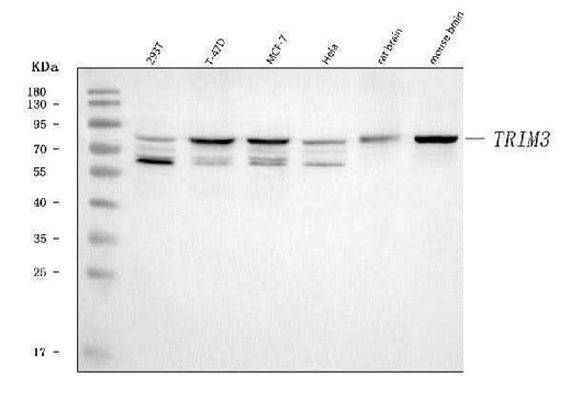 Anti-TRIM3 Antibody Picoband® Boster Bio