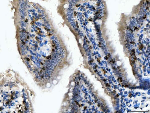 Anti-CD103/Itgae Antibody Boster Bio