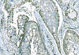 Anti-CD101 Antibody Boster Bio