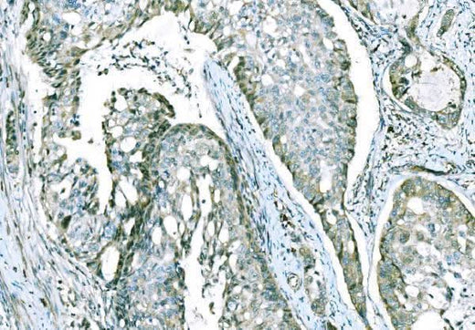 Anti-CD101 Antibody Boster Bio