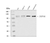 Anti-INPP4A Antibody Picoband® Boster Bio