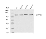 Anti-INPP4A Antibody Picoband® Boster Bio