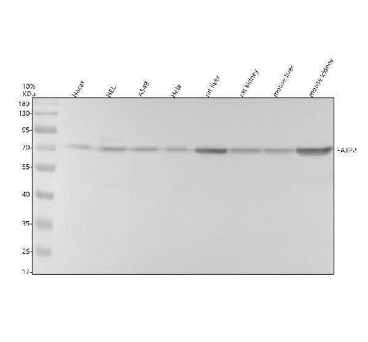 Anti-FATP2/SLC27A2 Antibody Picoband® Boster Bio