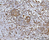 Anti-CCL14 Antibody Boster Bio
