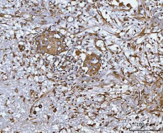 Anti-CCL14 Antibody Boster Bio