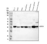 Anti-ARP2/3 subunit 1B/ARPC1B Antibody Picoband® Boster Bio