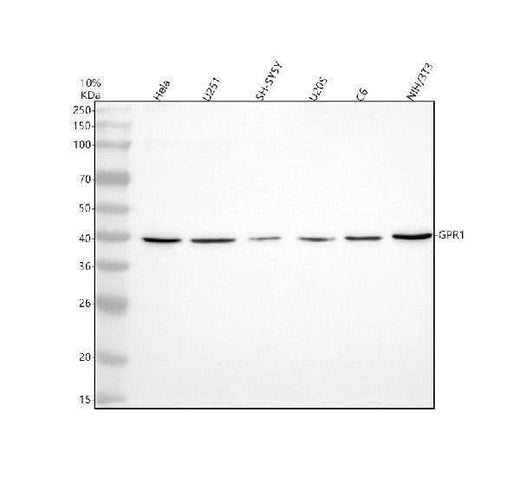 Anti-CMKLR2 Antibody Picoband® Boster Bio