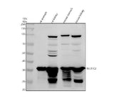 Anti-SULT1C2 Antibody Picoband® Boster Bio