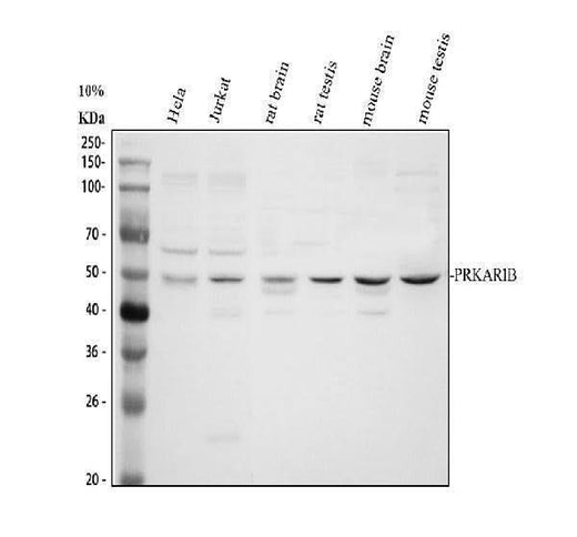 Anti-PRKAR1B Antibody Picoband® Boster Bio