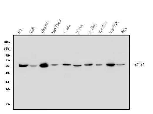 Anti-OXCT1/SCOT Antibody Picoband® Boster Bio