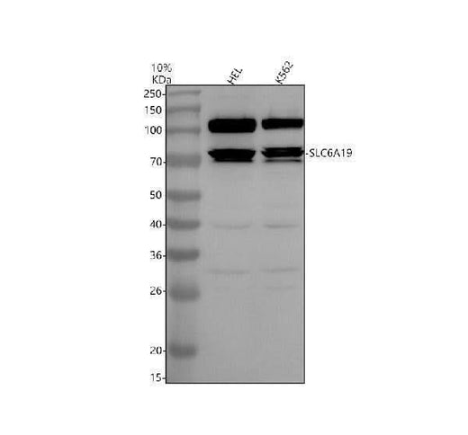 Anti-SLC6A19 Antibody Picoband® Boster Bio