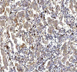 Anti-RASGRP3 Antibody Boster Bio