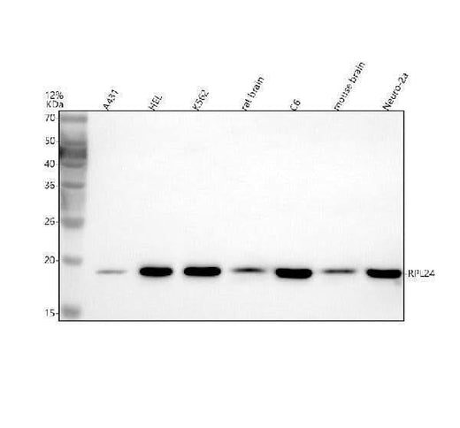 Anti-RPL24 Antibody Picoband® Boster Bio