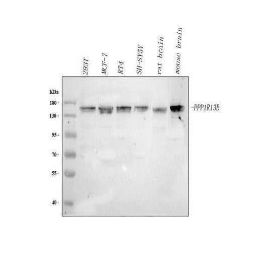 Anti-PPP1R13B Antibody Picoband® Boster Bio