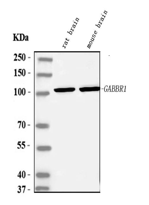 Anti-GABA B Receptor 1/GABBR1 Antibody Picoband® Boster Bio