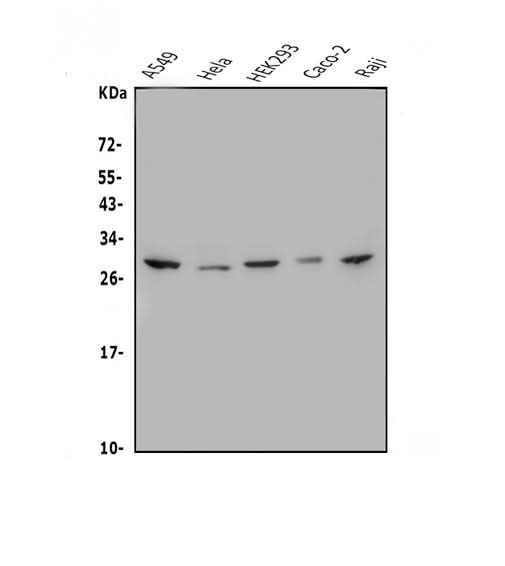 Anti-MESP1 Antibody Picoband® Boster Bio