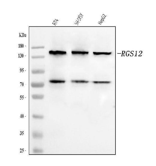 Anti-RGS12 Antibody Picoband® Boster Bio