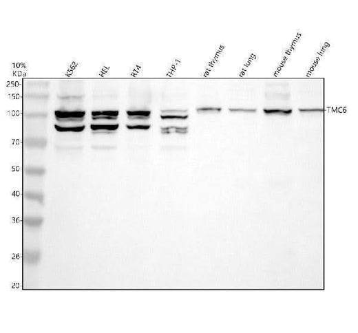 Anti-TMC6 Antibody Picoband® Boster Bio