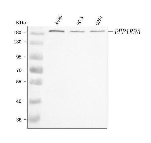 Anti-PPP1R9A Antibody Picoband® Boster Bio
