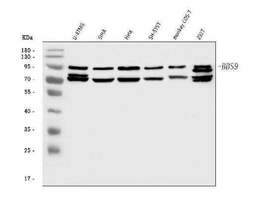 Anti-BBS9 Antibody Picoband® Boster Bio