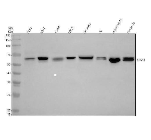 Anti-STK33 Antibody Picoband® Boster Bio