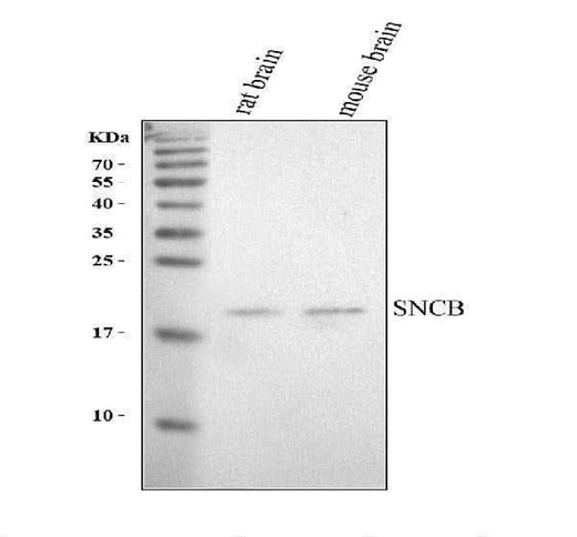 Anti-SNCB Antibody Picoband® Boster Bio