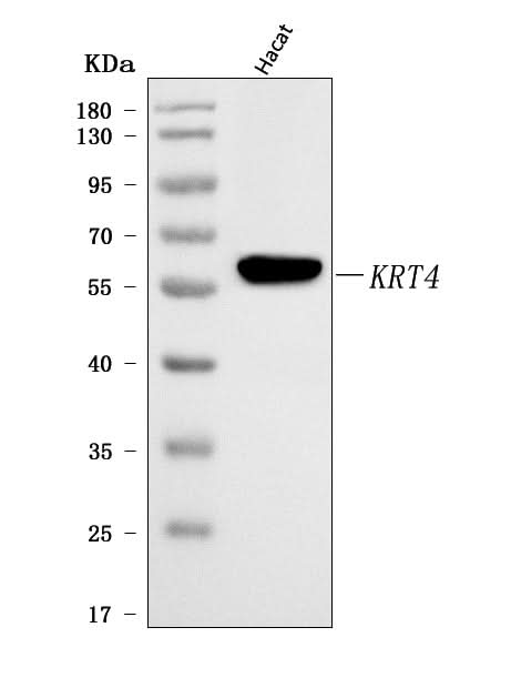 Anti-Cytokeratin 4/KRT4 Antibody Picoband® Boster Bio