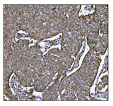 Anti-LRP1B Antibody Boster Bio
