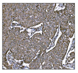 Anti-LRP1B Antibody Boster Bio